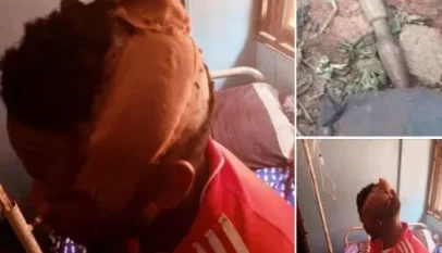 Tenant breaks landlord’s head with pestle over quit notice 3 tenant 1
